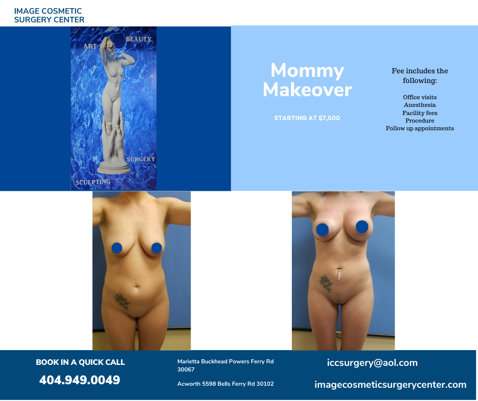 Mommy makeover and breast lift