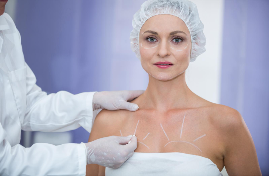 Breast Augmentation Recovery in Atlanta, GA: Differences Between Implants and Fat Transfer 